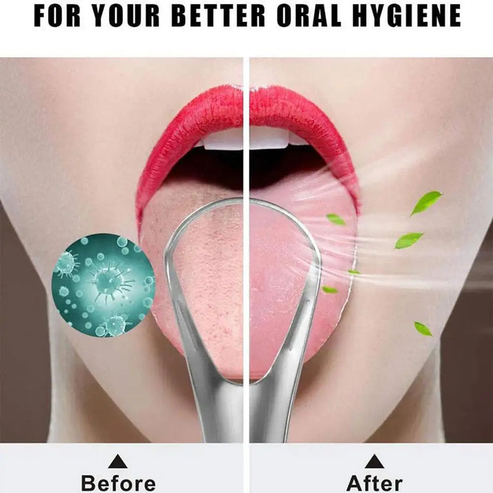 Stainless Steel Tongue Scraper 