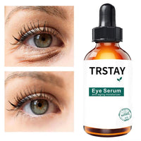 Retinol Anti-Aging Eye Serum 