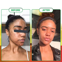 100G AFRICAN BLACK SOAP -  Shea Butter Bar