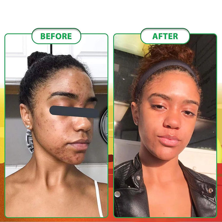 100G AFRICAN BLACK SOAP -  Shea Butter Bar