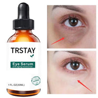 Retinol Anti-Aging Eye Serum 