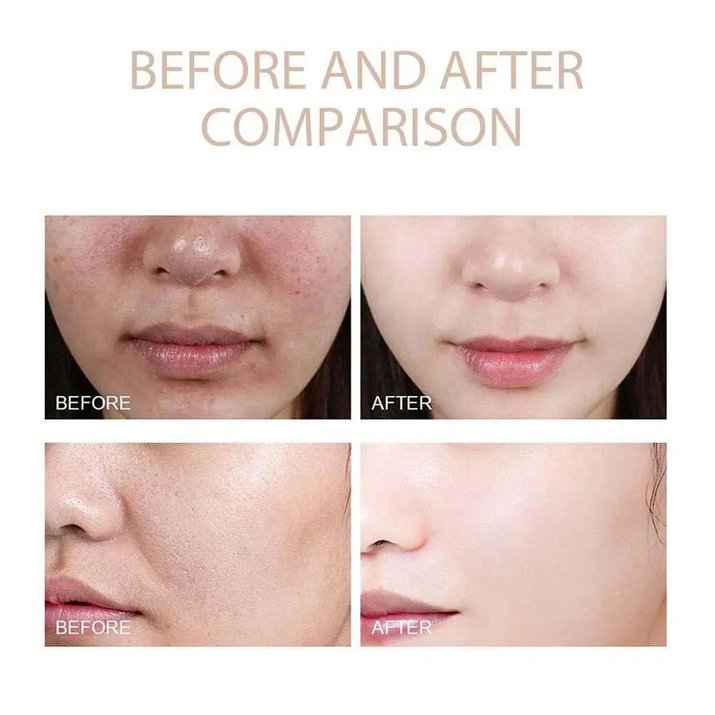 Korean Dr. Melaxin Rice Exfoliating Essence Moisturizing Peel Shot White and Black Soften Serum Gentle Exfoliation Skin Care